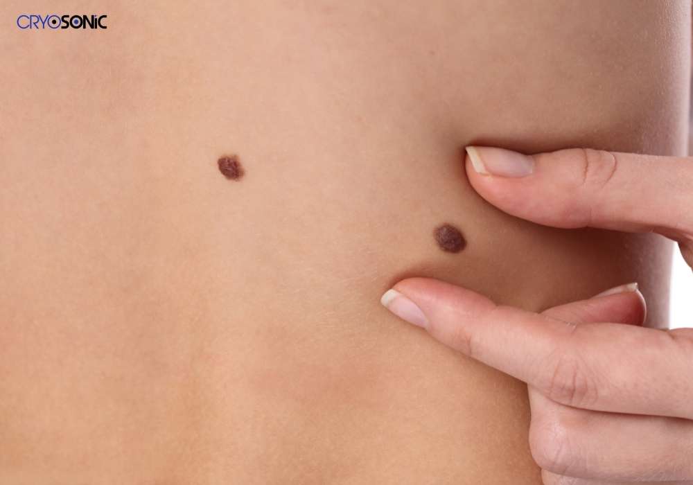 Infection Risk and Poor Aftercare Telford