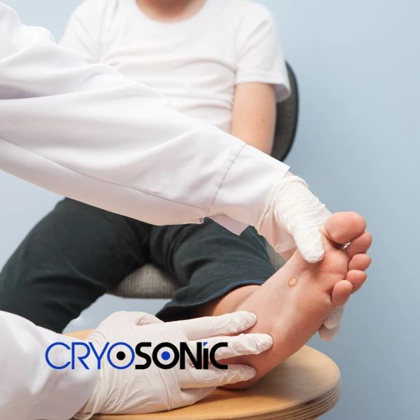 Are you looking for fast effective wart removal Contact us today Telford